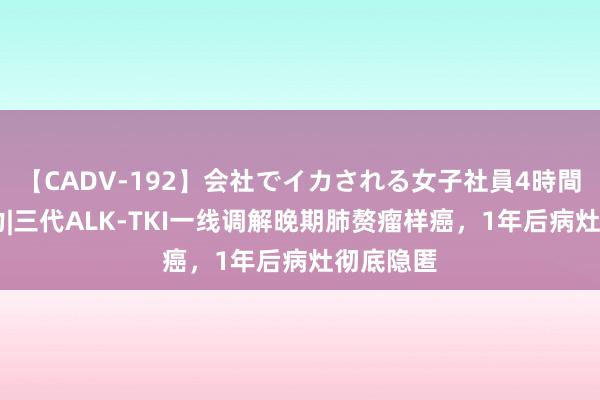 【CADV-192】会社でイカされる女子社員4時間 共同努力|三代ALK-TKI一线调解晚期肺赘瘤样癌，1年后病灶彻底隐匿